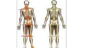 biomechanics